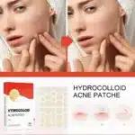 144pcs Acne Patch Set - Invisible Spot Stickers for All Skin Types - Image 2