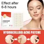 144pcs Acne Patch Set - Invisible Spot Stickers for All Skin Types - Image 3