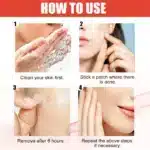 144pcs Acne Patch Set - Invisible Spot Stickers for All Skin Types - Image 5