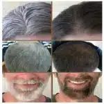 White hair killer, remove gray hair and restore natural hair color in 7 days - Image 2