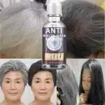 White hair killer, remove gray hair and restore natural hair color in 7 days - Image 4